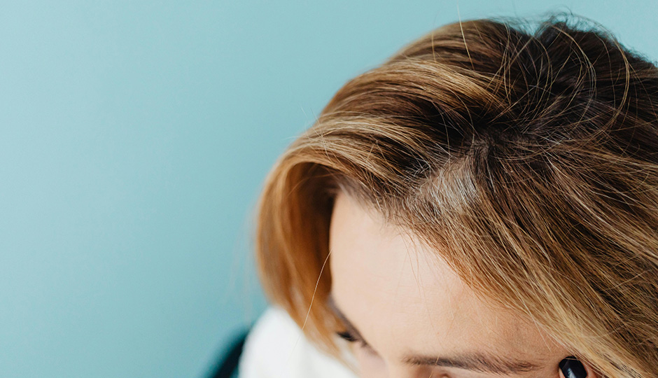 5 Signs Your Hair Loss Is Getting Worse - and When to Seek Help