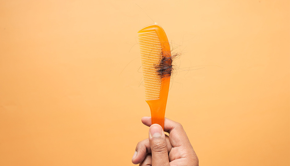 The Truth About Hair Loss in Your 20s and 30s: It