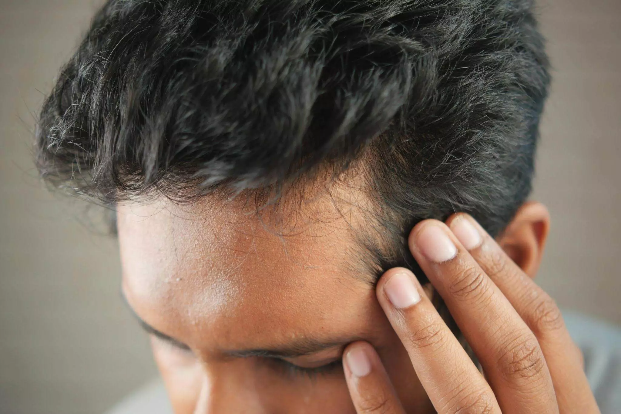 When Do Men Usually Start Balding? When Do Men Usually Start Balding?