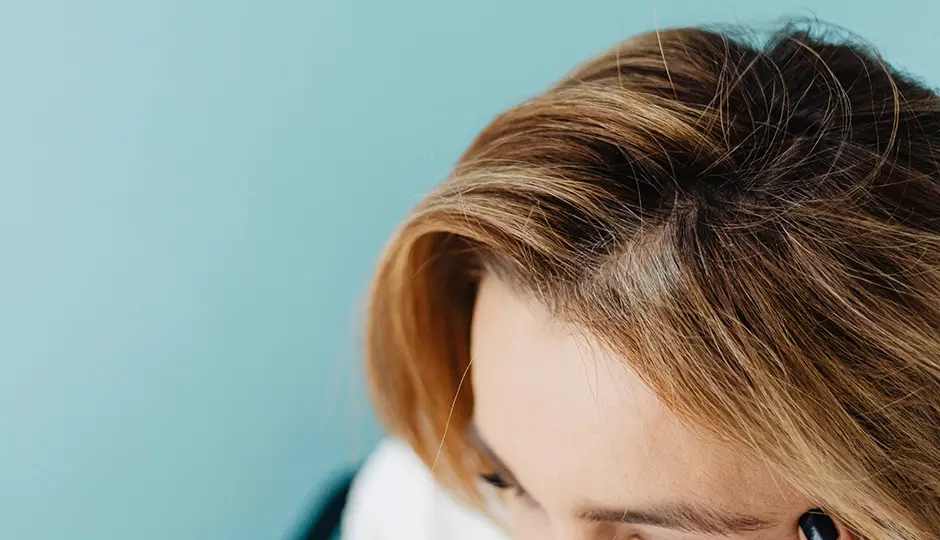 5 Signs Your Hair Loss Is Getting Worse - and When to Seek Help 5 Signs Your Hair Loss Is Getting Worse - and When to Seek Help