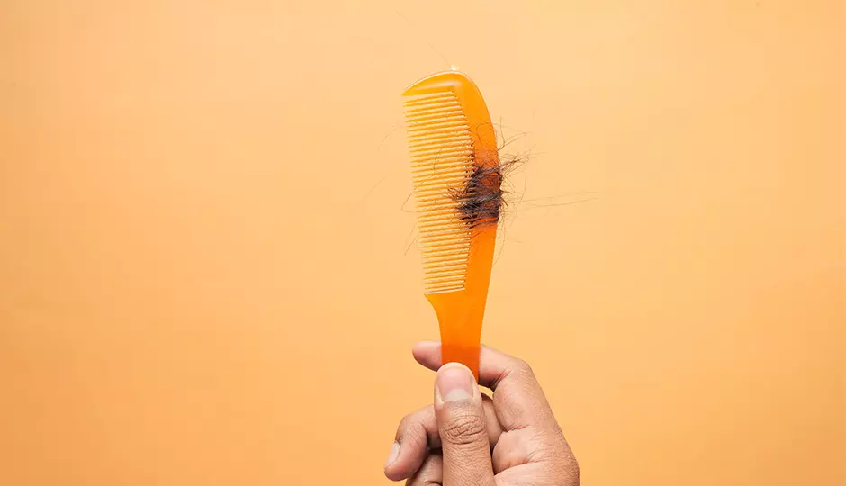 The Truth About Hair Loss in Your 20s and 30s: It's More Common Than You Think