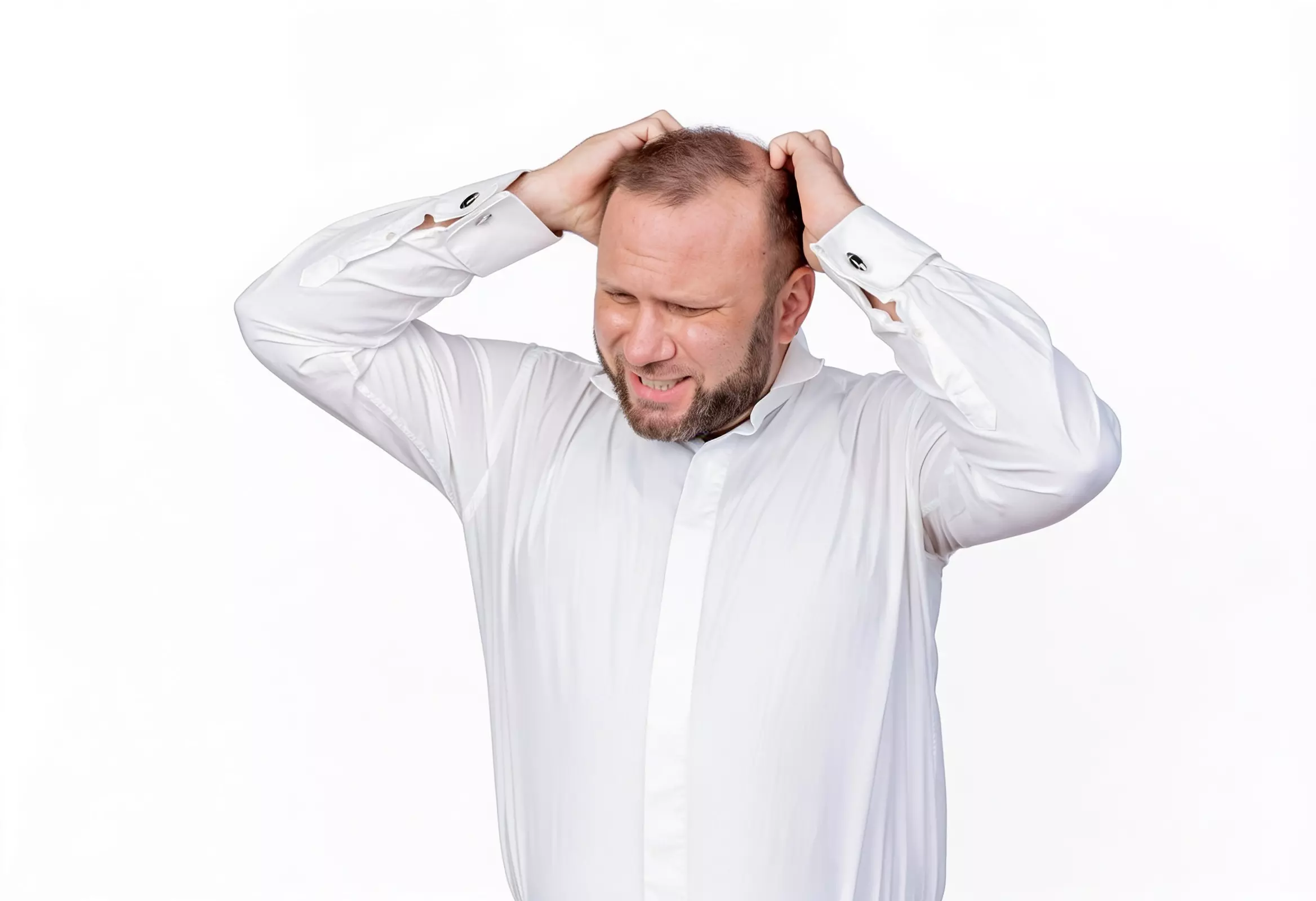Does Stress Cause Hair Loss in Men?