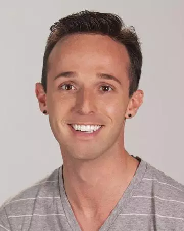 16 mens hair restoration systems before and after photo 01 solutions before after mens gallery hair restoration systems 16 mens hair restoration systems before and after photo 01