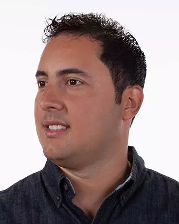 21 mens hair restoration systems before and after photo 01 solutions before after mens gallery hair restoration systems 21 mens hair restoration systems before and after photo 01