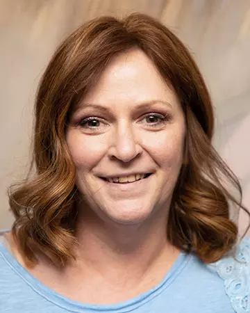 25 womens hair restoration systems before and after photo 01 solutions before after womens gallery hair restoration systems 25 womens hair restoration systems before and after photo 01