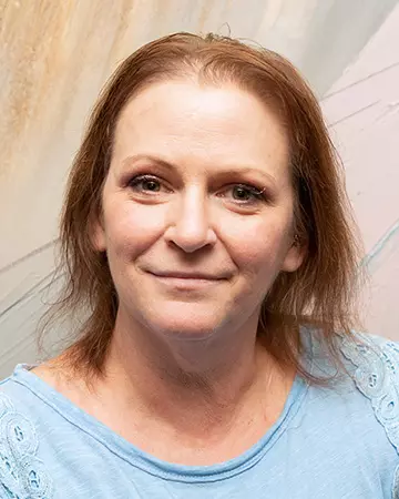 25 womens hair restoration systems before and after photo 02 solutions before after womens gallery hair restoration systems 25 womens hair restoration systems before and after photo 02